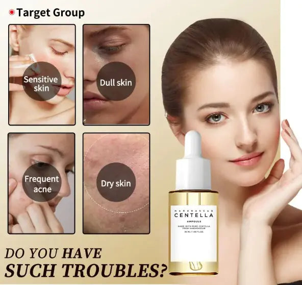 Skincare product advertisement with a woman's face and skin conditions on a beige background